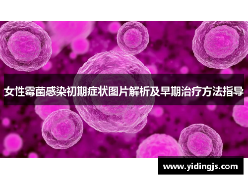 女性霉菌感染初期症状图片解析及早期治疗方法指导