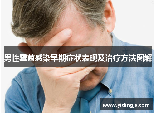 男性霉菌感染早期症状表现及治疗方法图解